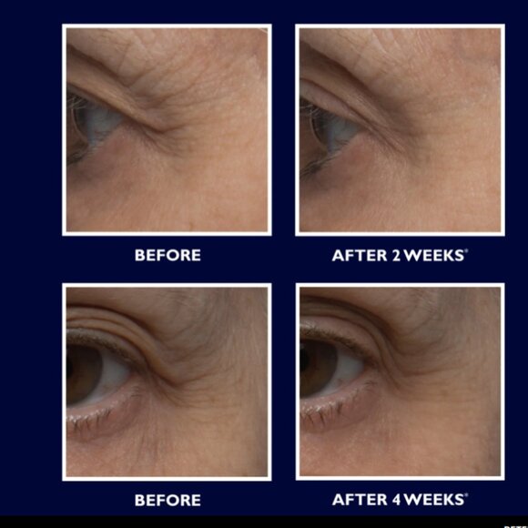 Peter Thomas Roth 5 pc Bundle SEALED xx Instant Firm Eye xx Retinol Fusion PM - Picture 5 of 5